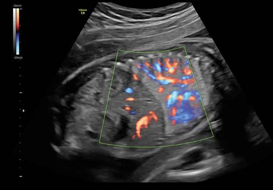 УЗИ аппарат General Electric Voluson E8