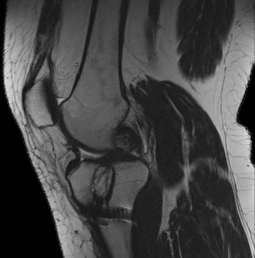 Аппарат МРТ Philips Ingenia 1.5T