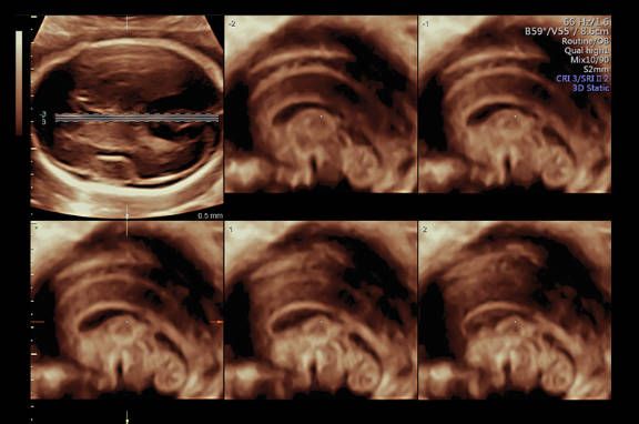 УЗИ аппарат General Electric Voluson E8