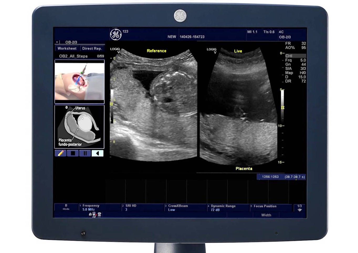 УЗИ аппарат General Electric Logiq V5