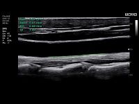 Samsung Medison HS30 Samsung Medison HS30