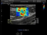 Samsung Medison RS85 Samsung Medison RS85