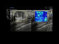 Samsung Medison RS85 Samsung Medison RS85