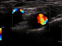 УЗИ аппарат General Electric Venue 50