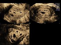 УЗИ аппарат General Electric Voluson E8