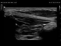 Samsung Medison V8 Samsung Medison V8