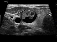 УЗИ аппарат General Electric Logiq V5