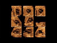 Samsung Medison W10 Samsung Medison W10