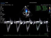 Samsung Medison V6 Samsung Medison V6