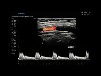 Samsung Medison RS85 Samsung Medison RS85