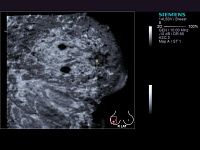 УЗИ аппарат Siemens ACUSON S2000