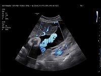 Samsung Medison V6 Samsung Medison V6