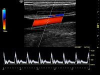 УЗИ аппарат General Electric Logiq P9