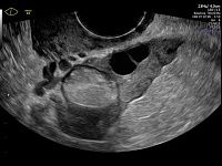 УЗИ аппарат General Electric Voluson E8