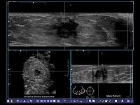 УЗИ аппарат Siemens ACUSON S2000