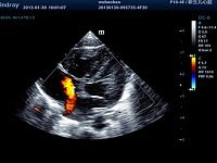 УЗИ аппарат Mindray DC-8