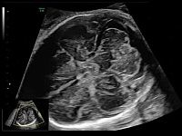 УЗИ аппарат General Electric Voluson E10