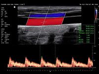 Samsung Medison V8 Samsung Medison V8