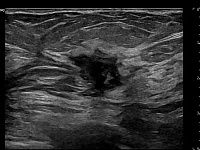 УЗИ аппарат General Electric Logiq E10