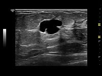 УЗИ аппарат General Electric Logiq P9