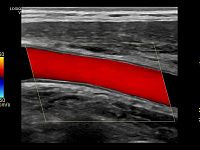 УЗИ аппарат General Electric Logiq V5