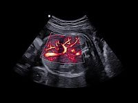 Samsung Medison W10 Samsung Medison W10