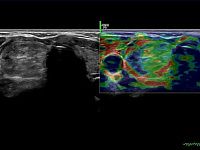 УЗИ аппарат General Electric Logiq P9