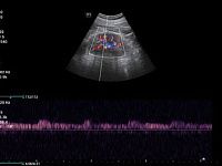 УЗИ аппарат Mindray Consona N6