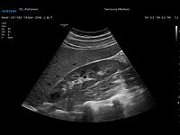 Samsung Medison V6 Samsung Medison V6