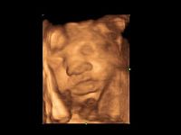 УЗИ аппарат General Electric Logiq P7