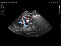 Samsung Medison V8 Samsung Medison V8