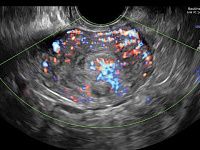 УЗИ аппарат General Electric Voluson E8