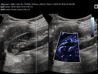 Samsung Medison RS85 Samsung Medison RS85