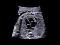 Samsung Medison W10 Samsung Medison W10