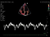 Samsung Medison V8 Samsung Medison V8