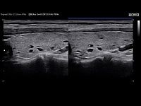 Samsung Medison HS30 Samsung Medison HS30