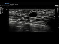 Samsung Medison RS85 Samsung Medison RS85