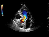 УЗИ аппарат General Electric Logiq P7