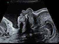 УЗИ аппарат General Electric Voluson E10