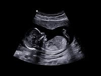 Samsung Medison W10 Samsung Medison W10