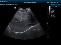 УЗИ аппарат Mindray DP-50 Color