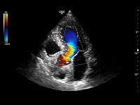 УЗИ аппарат General Electric Logiq P9