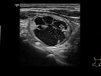 УЗИ аппарат General Electric Logiq P7