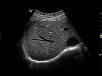 УЗИ аппарат General Electric Logiq P9