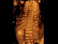 УЗИ Аппарат Mindray Z60