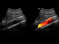 УЗИ аппарат General Electric Logiq P7