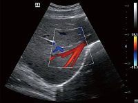 УЗИ Аппарат Mindray Z60