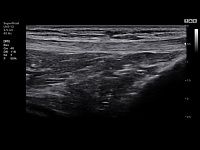 Samsung Medison HS30 Samsung Medison HS30