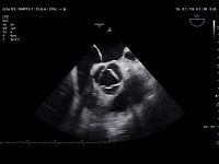 Samsung Medison V8 Samsung Medison V8