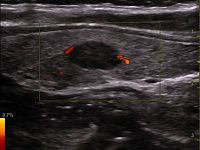 УЗИ аппарат General Electric Venue 50